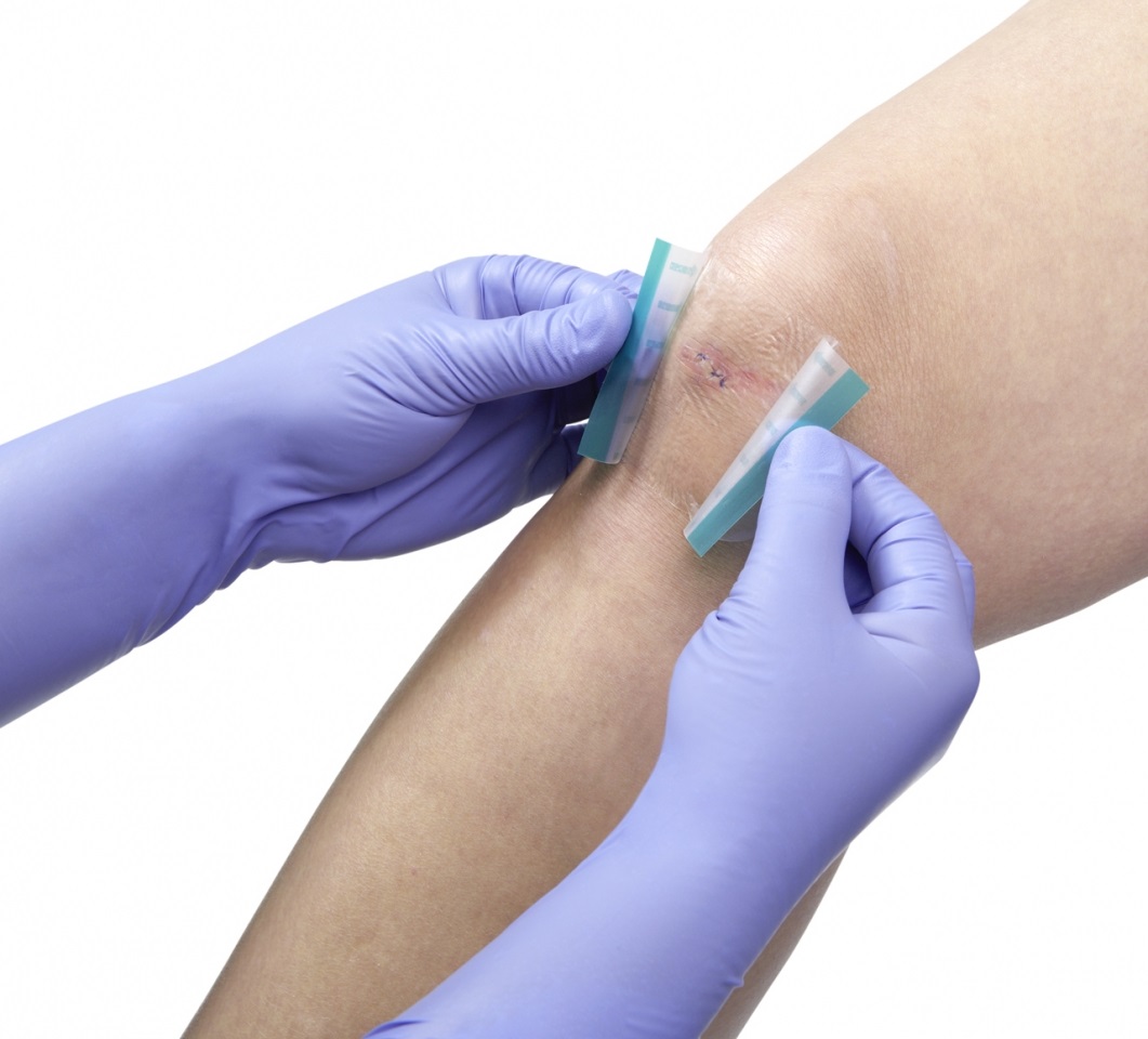 Klinion - Kliniderm - Steriele Wondfolie